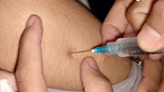 Injection lagane ka tarika  how to give intramuscular injection  nursing school Ep02 [upl. by Brigette]