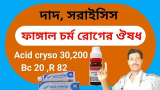 ফাংগাল ইনফেকশন হোমিওপ্যাথিক চিকিৎসা ।। Homeopathic Medicine for Fungal Skin ।। Acid cryso medicine [upl. by Annawt469]