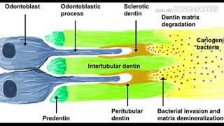 Structure of dentin  odontoblast  odontoblast processes  HD images labelled  important for viva [upl. by Erika]