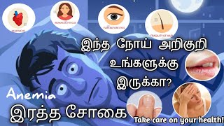 Anemia symptoms in Tamil  what is anemia in tamil  anemia in tamilSTAR LABORATORYanemia disease [upl. by Nylatsirk]