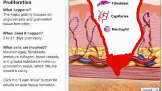 Stages of Wound Healing Process [upl. by Karwan694]