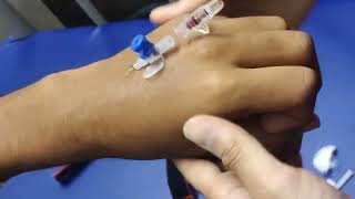 IV cannulation procedure [upl. by Eddi]