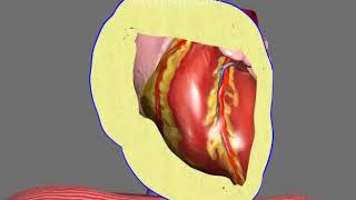 Pericardiocentesis in Pericardial Effusion and Cardiac Tamponade Animation by Cal Shipley MD [upl. by Westberg]