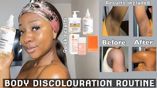 HOW I GOT RID OF MY BODY DISCOLOURATION  A Quick and Easy Guide for an even skin tone ‼️ [upl. by Maloy]