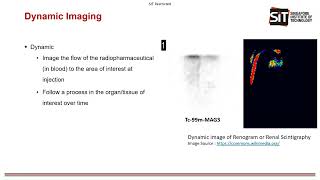 Gamma Camera and Type of Acquisition Made with Clipchamp [upl. by Doowron]