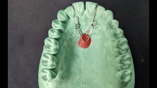 Finger Spring Fabrication  Removable Orthodontic Appliance  Orthodontics [upl. by Anwahsar202]