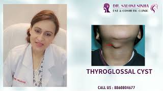 Neck Swelling DrSaloni SinhaThyroglossal CystThyroglossal Fistula [upl. by Nawoj]