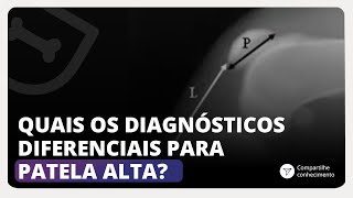 Quais os diagnósticos diferenciais para patela alta [upl. by Joseito]