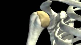 Shoulder joint dislocation [upl. by Jo-Anne851]