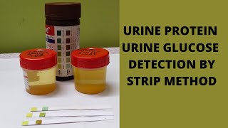 URINE ALBUMIN AND URINE GLUCOSE TEST PROCEDURE BI PARAMETER STRIP METHOD MLTPRACTICAL [upl. by Aisiat]