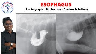 Esophagus  Radiology  Lecture 10 [upl. by Lorolla]