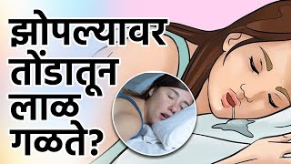 झोपल्यानंतर तोंडातून लाळ गळते का ।Do you Drool Saliva While Sleeping  Causes  Lokmat Health [upl. by Marte266]