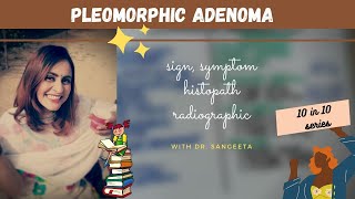 pleomorphic adenoma I oral pathology lectures [upl. by Kress]