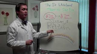 Dr Whiteboard Treating Dry Eye With Restasis [upl. by Dlarrej]