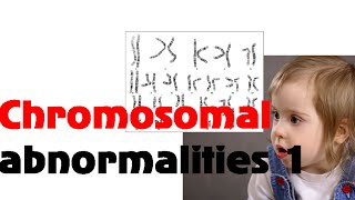 Chromosomal abnormalities 1 [upl. by Teryl919]