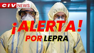 Civ News  Alerta por LEPRA [upl. by Bosch]