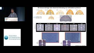 Jerome Sallet  Cortical transcranial ultrasound stimulation 2018 [upl. by Thelma]