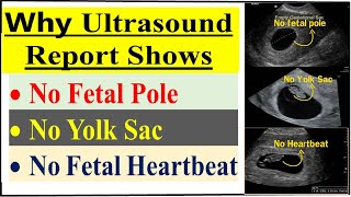 Why Heartbeat Never Comes In Early Pregnancy No fetal pole। No Yolk Sac । No fetal heartbeat [upl. by Eniawtna]