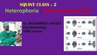 COVER uncover TEST  heterophoria  SQUINT CLASS  ophthalmology classes  strabismus [upl. by Zug]