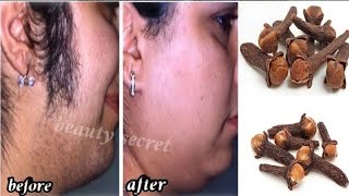 Cloves are stronger than laser Permanently eliminates unwanted hair 5 minutes [upl. by Atled]