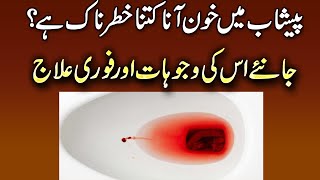 Peshab Mein Khoon Ka Ilaj  Blood In Urine Treatment Urdu  UTI Infection Men amp Women  Hematuria [upl. by Hardin]