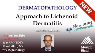 Dermatopathology Approach to Lichenoid Dermatitis  w Dr Singh [upl. by Anya]