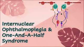 Internuclear Ophthalmoplegia amp One And A Half Syndrome [upl. by Nellad]