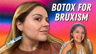 I Got Masseter Botox for Bruxism My Experience Cost Results and Side Effects  Under Eye Botox [upl. by Eelirem314]