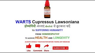 WARTS Cupressus Lawsoniana  Homeopathic Medicine  Dr Sita Raman Gupta [upl. by Roque203]