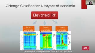 Update on pathophysiology and work up for Achalasia [upl. by Susann459]