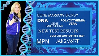 Bone Marrow Biopsy Results Gene Mutations Jak2V617F MPN Polycythemia Vera [upl. by Amadas]