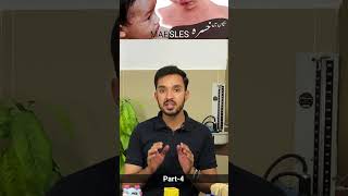 Check complete video on measles on my channel بچوں میں خسرہ measles doctor kidshealth [upl. by Victory]