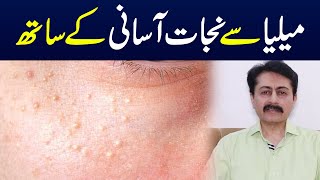 Milia causes symptoms and treatment  Dr Faisal Syed [upl. by Mokas237]