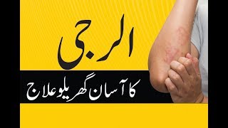 Natural Home Remedies For Skin Allergy in UrduAllergy Ka Asan ilaj [upl. by Rihat965]