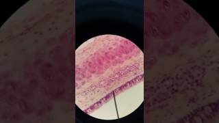 pseudostratified epithelium  Trachea [upl. by Oznerol]