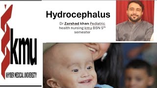 hydrocephalus pediatric health nursing kmu BSN 5th semester [upl. by Suzanna971]