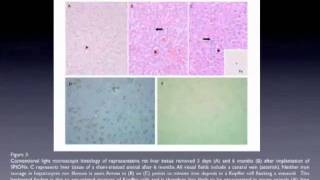 Superparamagnetic iron oxide nanoparticles  Video abstract 23638 [upl. by Ennasus]