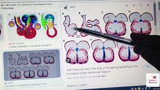 FCPS1CVS EMBRYOLOGY lecture 2 ventricular septationoutflow tract and valve formationaortic arches [upl. by Gunthar]