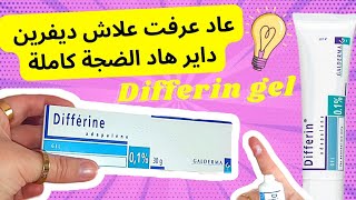 تجربتي مع differin gel  ديفرين للوجه [upl. by Eelarbed835]