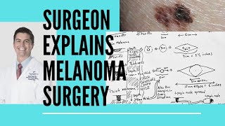 Surgeon explains melanoma surgery [upl. by Eisus756]