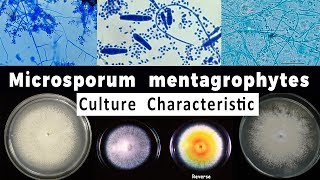 Trichophyton mentagrophytes culture Characteristic [upl. by Analli843]