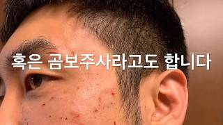 스킨부스터 리쥬란힐러  재생주사 피부 재생 보습을 위한 특별한 제안 괴물주사곰보주사 극혐주사 Monster injection [upl. by Meredeth]