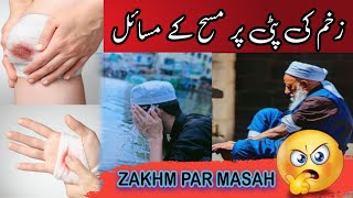 ZAKHM PAR MASAH Wazu Ke Masail masail wazukemasail [upl. by Nasar78]