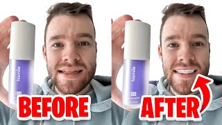 HiSmile v34 Colour Corrector  Get White Teeth Easy  Honest Review [upl. by Nitsir]