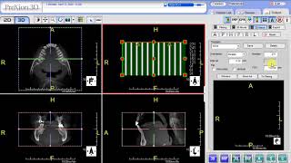 PreXion Training Tips Reslice CBCT DICOM Datasets [upl. by Polish]