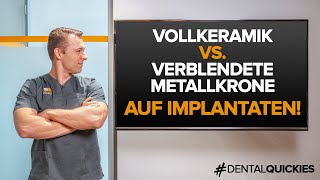 Was ist besser Vollkeramikkrone oder Metallverblendkrone auf Implantaten Wir klären auf [upl. by Nojed]