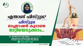 ഫിസ്റ്റുല ഓപ്പറേഷൻ കൂടാതെ മാറ്റിയെടുക്കാം  Fistula Malayalam  Dr Mahroofa [upl. by Ymmat445]