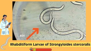 Understanding Strongyloides Rhabditiform Larvae A Comprehensive Guide  Parasitology [upl. by Gyatt]