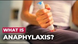 Understanding Anaphylaxis LifeSaving Info You Need to Know shorts youtubeshorts [upl. by Hilleary]