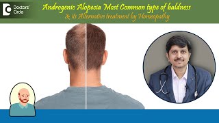 BaldnessAndrogenic AlopeciaAlternative Treatment by Homeopathy DrSanjay PanickerDoctors Circle [upl. by Buffo]